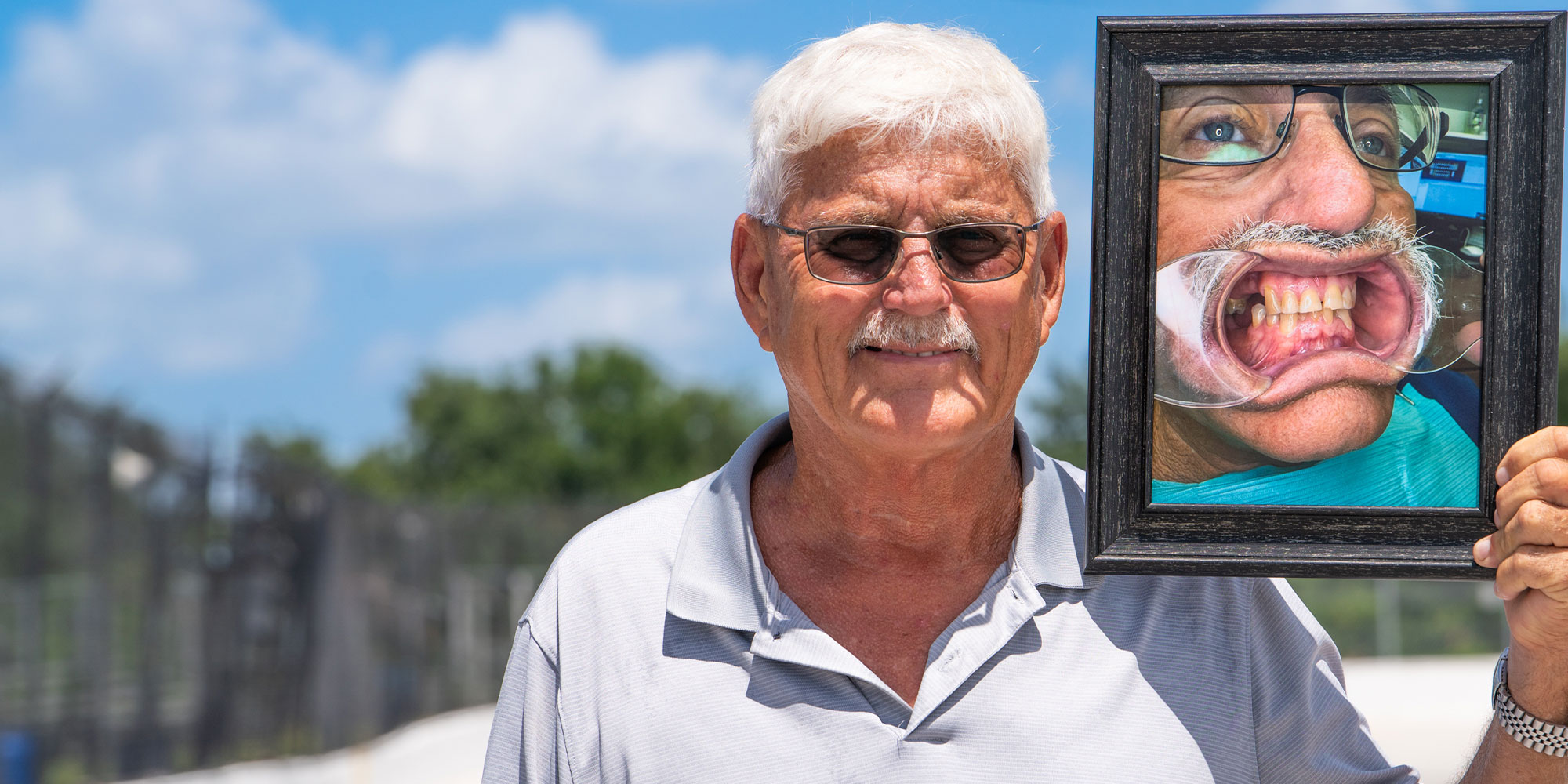 Patient Holding up a before and after photo